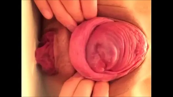 Big japanese prolapse top Clips