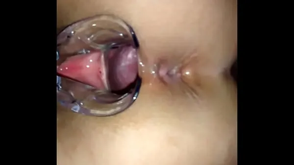 Grote Inside the pussy with vaginal speculum topclips