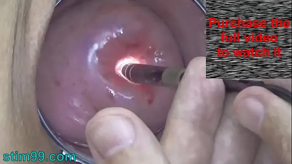 Big Endoscope Camera inside Cervix Cam into Pussy Uterus top Clips