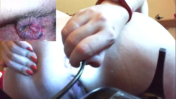 بڑے Medical anal endoscope fisting and extreme masturbation ٹاپ کلپس