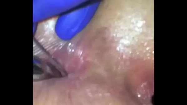 Anal injections female Clip hàng đầu lớn