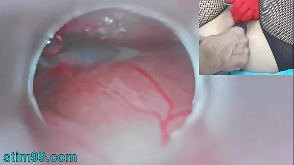 Big Uncensored Japanese Insemination with Cum into Uterus and Endoscope Camera by Cervix to watch inside womb top Clips